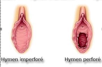 Les mythes autour de l'hymen