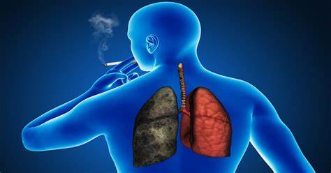 Cancer : le nombre de cas va augmenter de 77% d'ici 2050 selon l'OMS Cancer : le nombre de cas va augmenter de 77% d'ici 2050 selon l'OMS