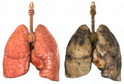 Poumons sains  et poumons de fumeur