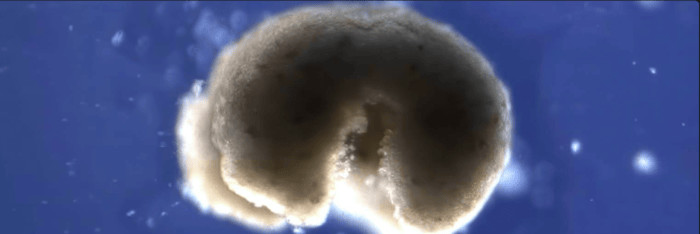 Anthrobots Anthrobots