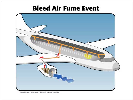 Quand l'air de nos avions est toxique