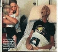 Cette image en fera fuir certains, mais c'est la réalité : fumer tue !