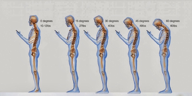 Poids exercé sur les cervicales, selon l'inclinaison de la tête. 1 ibs~ 0,5 kg (0,45 exactement). Sans oublier qu'il faut également tenir compte du temps passé dans cette (fâcheuse) position !