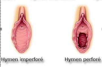 Les mythes autour de l'hymen Les mythes autour de l'hymen