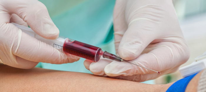 Une seule prise de sang suffira bientôt à détecter (très précocement) 25 cancers !
