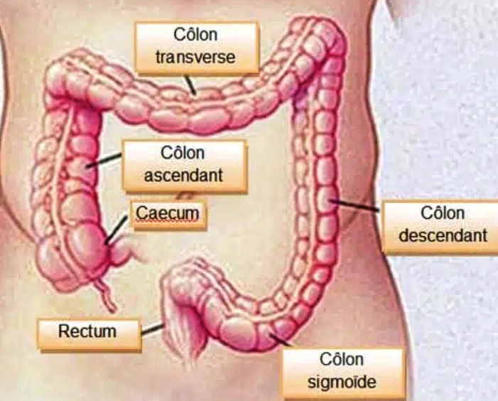 ​Cancer du côlon : 7 symptômes qui nécessitent une investigation urgente