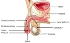 Hypertrophie bénigne de la prostate : l'opération
