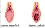 Les mythes autour de l'hymen