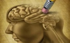 ALZHEIMER : la découverte qui change tout !
