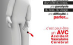 Comment repérer un AVC