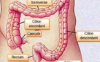 ​Cancer du côlon : 7 symptômes qui nécessitent une investigation urgente