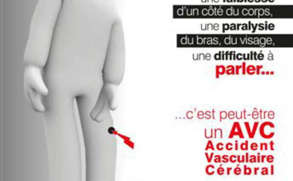 Comment repérer un AVC