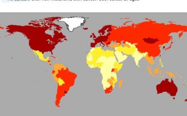 Le nombre de cancers a bondi de 80 % en trois décennies, chez les moins de 50 ans